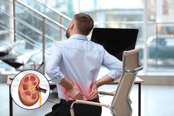 man holding his back in pain due to kidney stones.